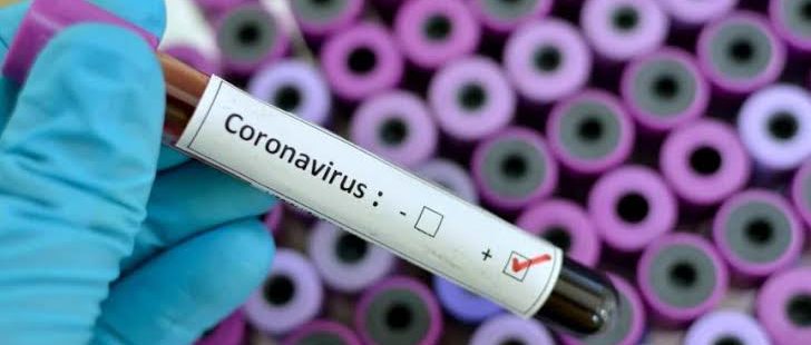 Sesa avalia 12 casos suspeitos do novo coronavírus. Nove já foram descartados no Ceará